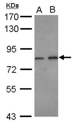 Western Blot: DIP13B Antibody [NBP2-16164]