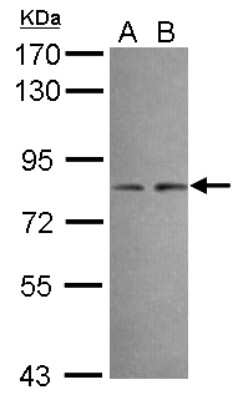 Western Blot: DIP13B Antibody [NBP2-16165]