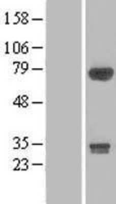 Western Blot: DIP13B Overexpression Lysate [NBL1-07634]