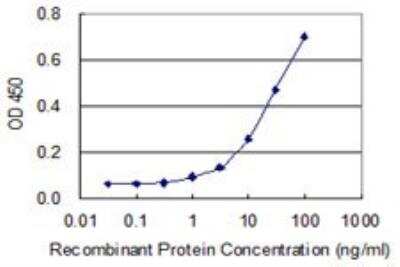 ELISA: DIP2A Antibody (4E6) [H00023181-M01]