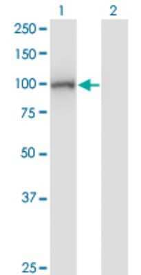 Western Blot: DIP2A Antibody (4E6) [H00023181-M01]