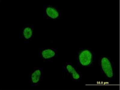 Immunocytochemistry/ Immunofluorescence: DIP2A Antibody [H00023181-B01P]
