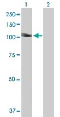 Western Blot: DIP2A Antibody [H00023181-B01P]