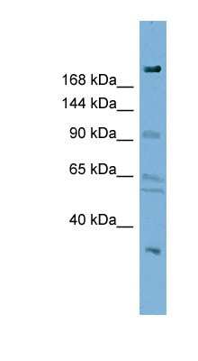 Western Blot: DIP2A Antibody [NBP1-56909]