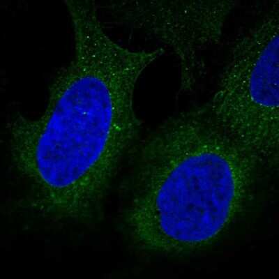 Immunocytochemistry/ Immunofluorescence: DIP2B Antibody [NBP2-58276]