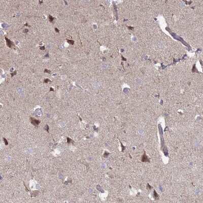 Immunohistochemistry-Paraffin: DIP2B Antibody [NBP2-14563]