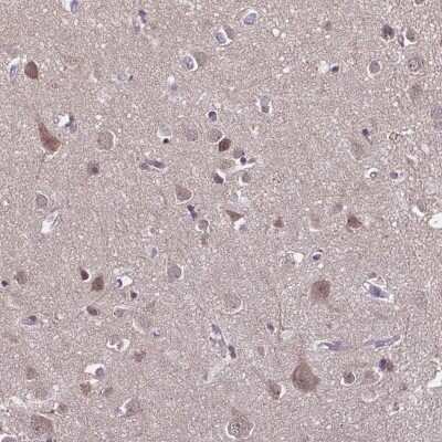 Immunohistochemistry-Paraffin: DIP2B Antibody [NBP2-38779]