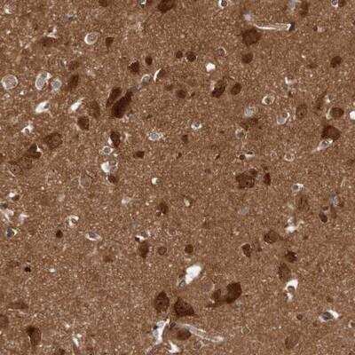 Immunohistochemistry-Paraffin: DIP2C Antibody [NBP1-81461]