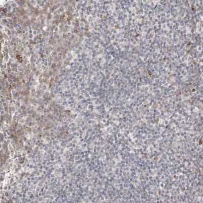 Immunohistochemistry-Paraffin: DIP2C Antibody [NBP1-81461]