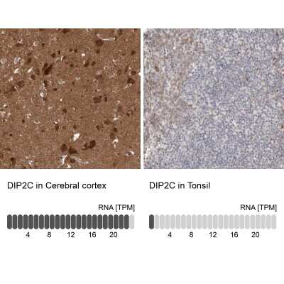 Immunohistochemistry-Paraffin: DIP2C Antibody [NBP1-81461]