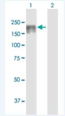 Western Blot: DIP2C Antibody [H00022982-B01P-50ug]