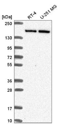 Western Blot: DIP2C Antibody [NBP2-57233]