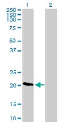 Western Blot: DIRAS1 Antibody [H00148252-B01P]