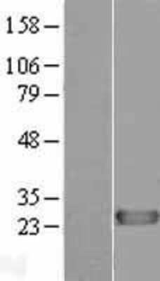 Western Blot: DIRAS1 Overexpression Lysate [NBL1-09889]