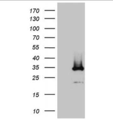 Western Blot: DIRAS2 Antibody (OTI10H1)Azide and BSA Free [NBP2-71967]