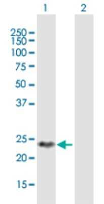 Western Blot: DIRAS2 Antibody [H00054769-B01P]