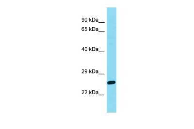 Western Blot: DIRAS2 Antibody [NBP2-86617]