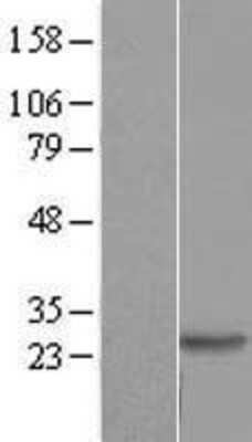 Western Blot: DIRAS2 Overexpression Lysate [NBL1-09890]