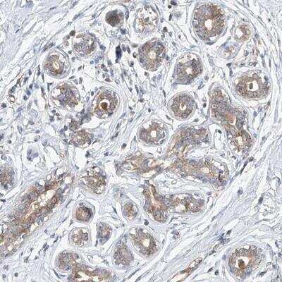 Immunohistochemistry: DIRAS3 Antibody [NBP1-90104]