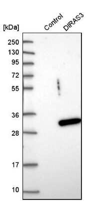 Western Blot: DIRAS3 Antibody [NBP1-90106]