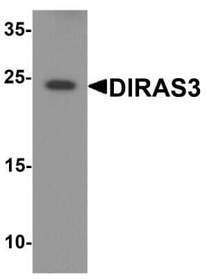 Western Blot: DIRAS3 AntibodyBSA Free [NBP2-82085]