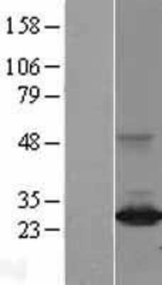 Western Blot: DIRAS3 Overexpression Lysate [NBL1-09891]