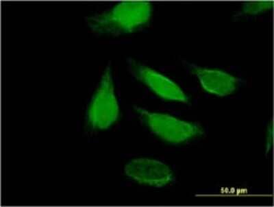 Immunocytochemistry/ Immunofluorescence: DIS3 Antibody (2C7) [H00022894-M01]