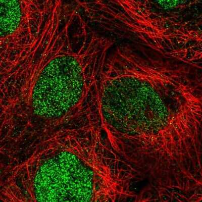 Immunocytochemistry/ Immunofluorescence: DIS3 Antibody [NBP2-55359]