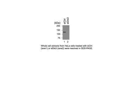 Western Blot: DIS3 Antibody [H00022894-B01P]