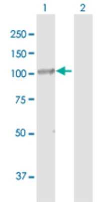 Western Blot: DIS3 Antibody [H00022894-B01P]