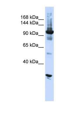 Western Blot: DIS3 Antibody [NBP1-57189]