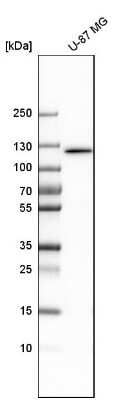 Western Blot: DIS3 Antibody [NBP1-85209]
