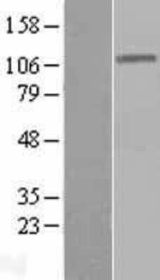 Western Blot: DIS3 Overexpression Lysate [NBL1-09892]