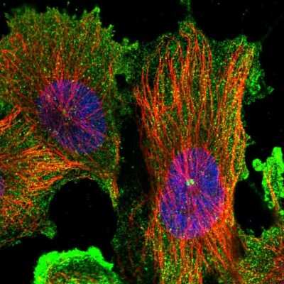 Immunocytochemistry/ Immunofluorescence: DIS3L Antibody [NBP1-81941]