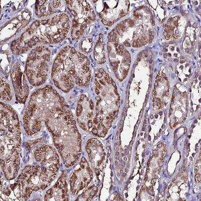 Immunohistochemistry-Paraffin: DIS3L Antibody [NBP1-81941]