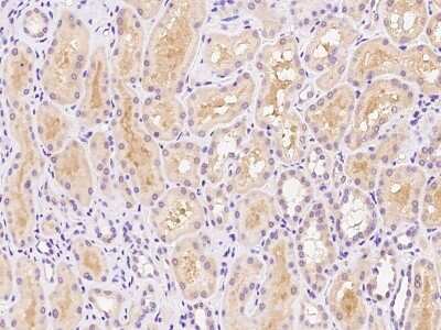 Immunohistochemistry-Paraffin: DIS3L Antibody [NBP2-97612]