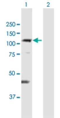 Western Blot: DIS3L Antibody [H00115752-B01P]