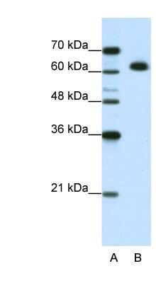 Western Blot: DIS3L2 Antibody [NBP1-80479]