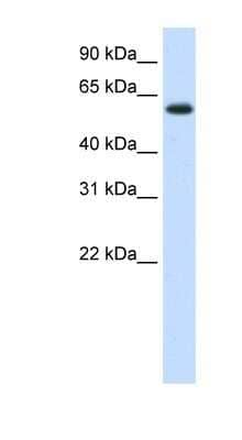 Western Blot: DIS3L2 Antibody [NBP1-80480]