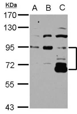 Western Blot: DIS3L2 Antibody [NBP2-16166]