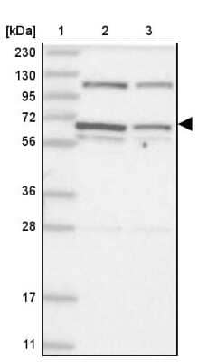 Western Blot: DIS3L2 Antibody [NBP2-38264]