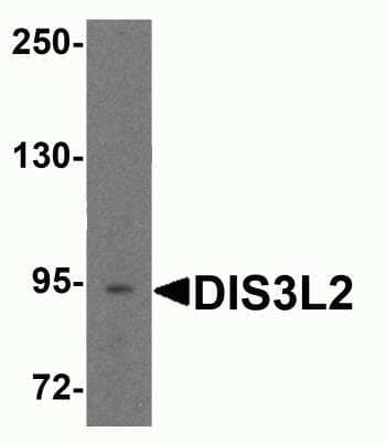 Western Blot: DIS3L2 AntibodyBSA Free [NBP2-81805]