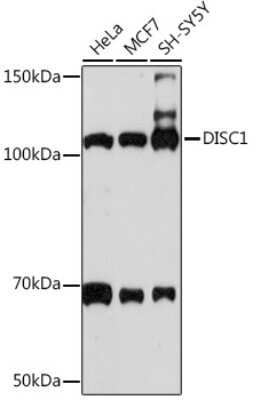 Western Blot: DISC1 Antibody (4U5N1) [NBP3-16462]