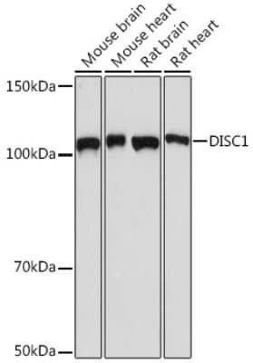 Western Blot: DISC1 Antibody (4U5N1) [NBP3-16462]