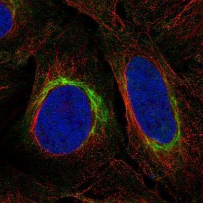 Immunocytochemistry/ Immunofluorescence: DISC1 Antibody [NBP2-76538]