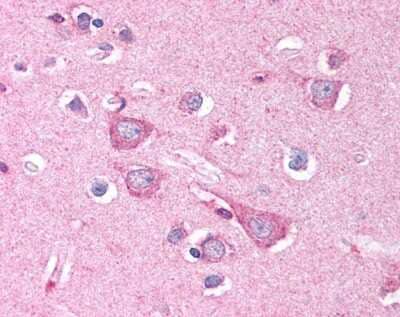 Immunohistochemistry: DISC1 Antibody [NB110-40773]
