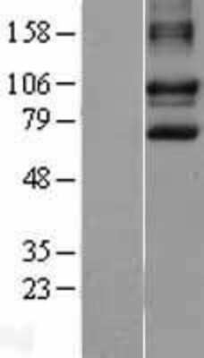 Western Blot: DISC1 Overexpression Lysate [NBL1-09895]