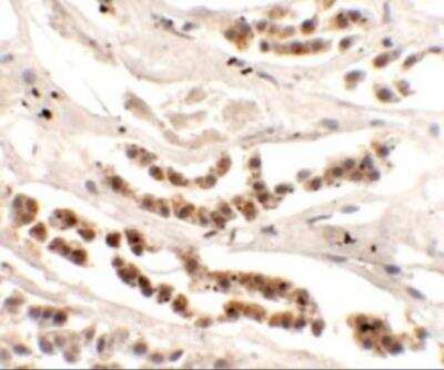 Immunohistochemistry: DISP1 Antibody - BSA Free [NBP2-81818]