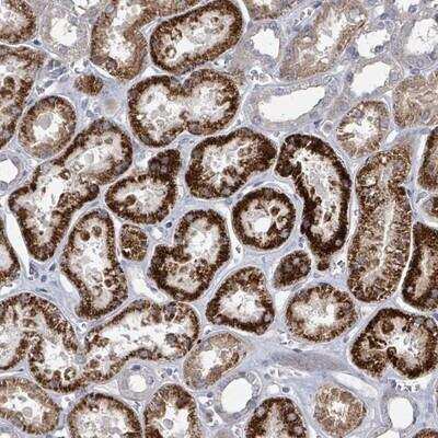 Immunohistochemistry-Paraffin: DISP1 Antibody [NBP2-13925]