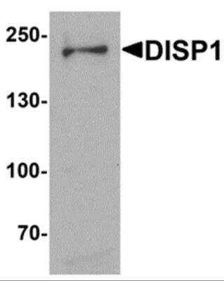 Western Blot: DISP1 AntibodyBSA Free [NBP2-81818]